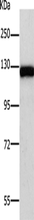 PARP1 Polyclonal Antibody (E-AB-12834)