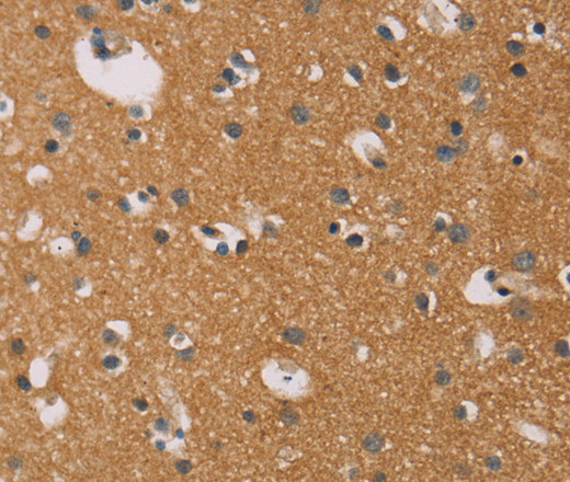 CD22 Polyclonal Antibody (E-AB-14843)