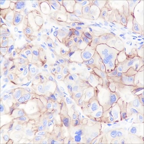 Recombinant CD47 Monoclonal Antibody (AN301480L)