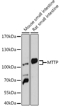 MTTP Polyclonal Antibody (E-AB-90724)