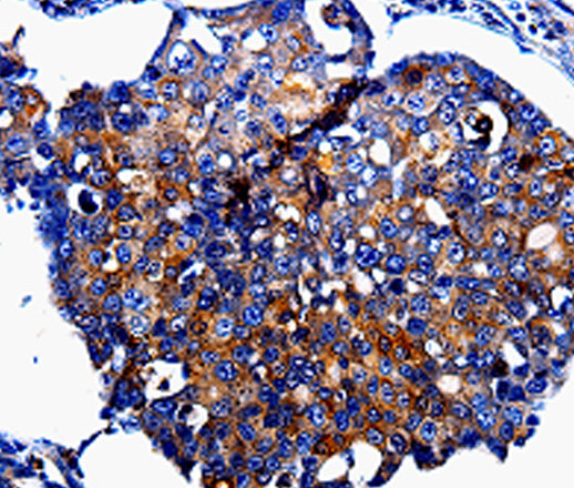 IL10RB Polyclonal Antibody (E-AB-13870)