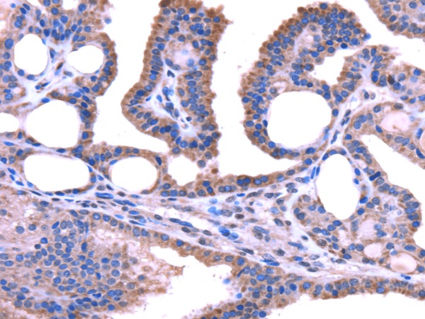 TRIM49 Polyclonal Antibody (E-AB-17092)