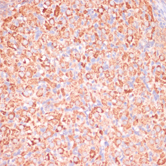ATP5C1 Polyclonal Antibody (E-AB-65237)