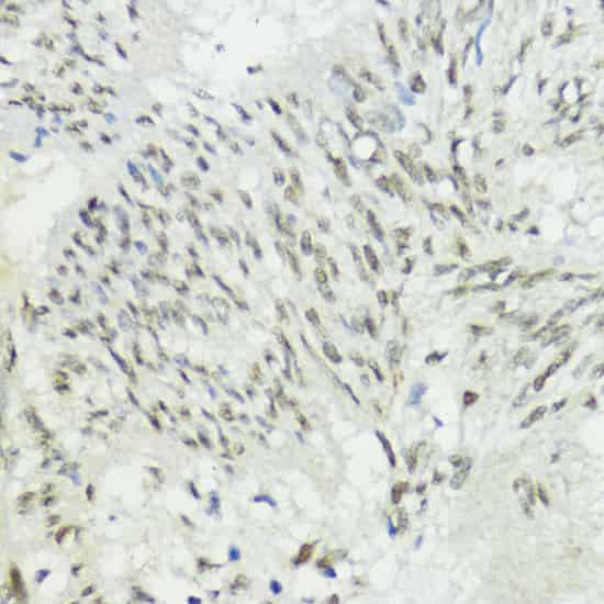 ZEB1 Polyclonal Antibody (E-AB-66379)