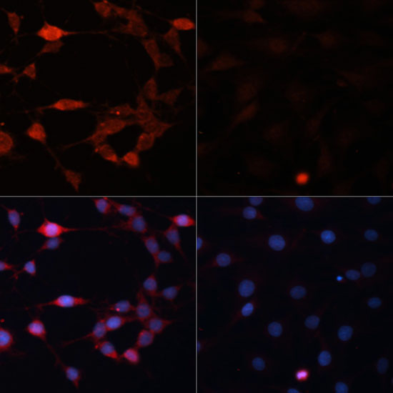 P70 S6K Polyclonal Antibody (E-AB-60672)