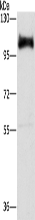 DAB2 Polyclonal Antibody (E-AB-14925)