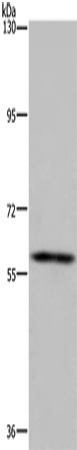 FTO Polyclonal Antibody (E-AB-11248)