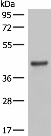 LMCD1 Polyclonal Antibody (E-AB-19000)