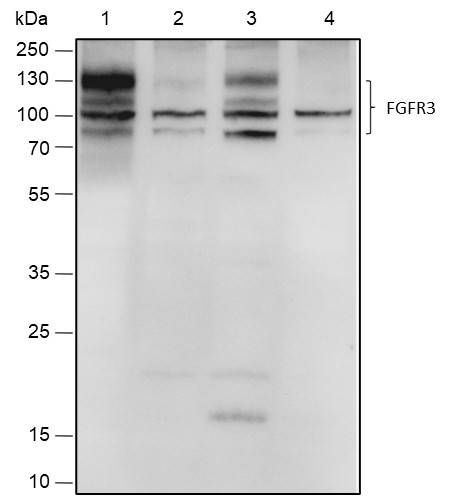 Recombinant FGFR3 Monoclonal Antibody (AN301784L)