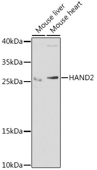 HAND2 Polyclonal Antibody (E-AB-61488)