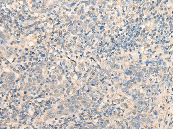 MR1 Polyclonal Antibody (E-AB-18673)
