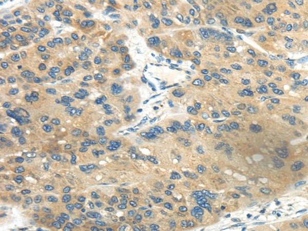 CD70 Polyclonal Antibody (E-AB-17583)