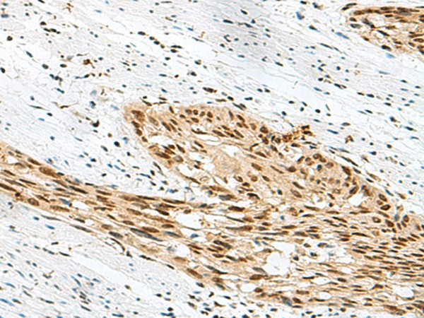 RBM12 Polyclonal Antibody (E-AB-18869)