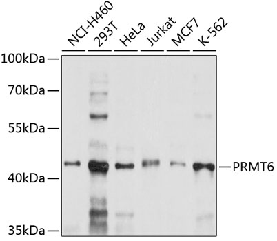 PRMT6 Polyclonal Antibody (E-AB-92469)