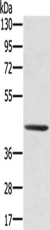 SCPEP1 Polyclonal Antibody (E-AB-11543)