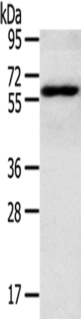 RORA Polyclonal Antibody (E-AB-13577)