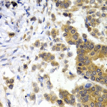 NEFL Polyclonal Antibody (E-AB-60048)