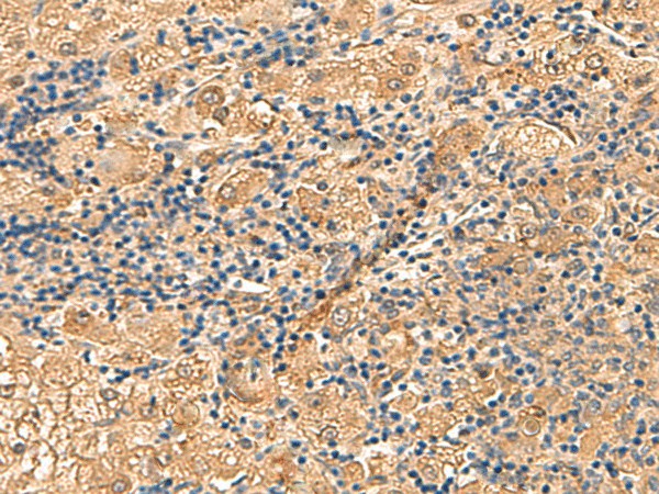 PTH1R Polyclonal Antibody (E-AB-52894)