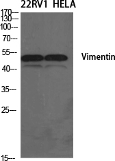 Vimentin Polyclonal Antibody (E-AB-33217)