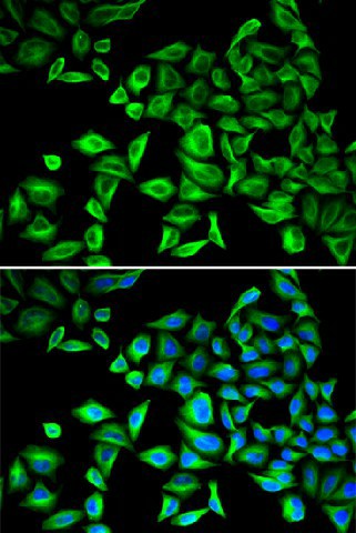 CRP Polyclonal Antibody (E-AB-60021)