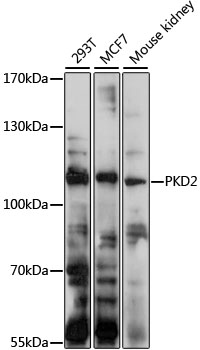 PKD2 Polyclonal Antibody (E-AB-92540)