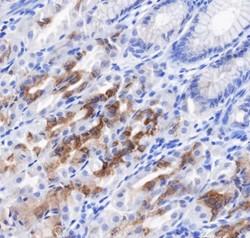 Recombinant Gastric Mucin-6/MUC6 Monoclonal Antibody (AN301775L)