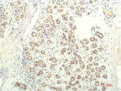 STAT1 Monoclonal Antibody (E-AB-22205)