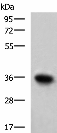 TNNT1 Polyclonal Antibody (E-AB-53126)