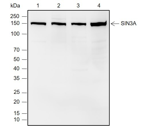 Recombinant SIN3A Monoclonal Antibody (AN302059L)