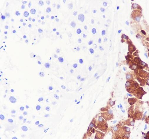 Recombinant INSL3 Monoclonal Antibody (AN301891L)