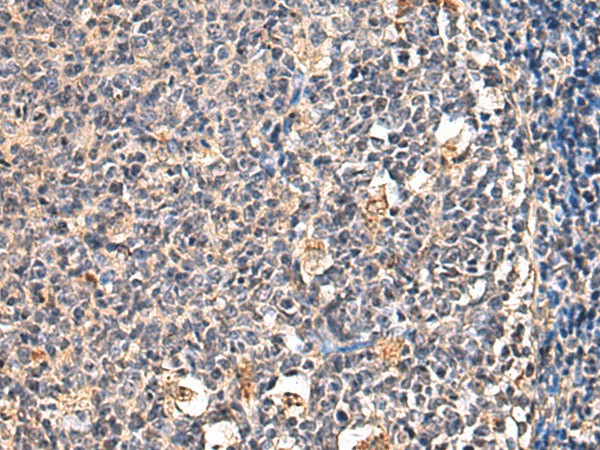 ENTPD1 Polyclonal Antibody (E-AB-53347)