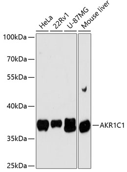 AKR1C1 Polyclonal Antibody (E-AB-64412)