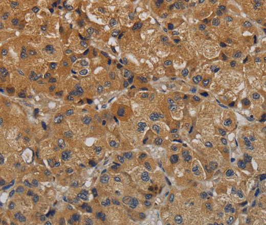 TAB1 Polyclonal Antibody (E-AB-15186)