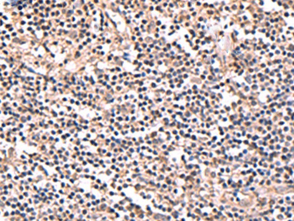 PER3 Polyclonal Antibody (E-AB-52923)
