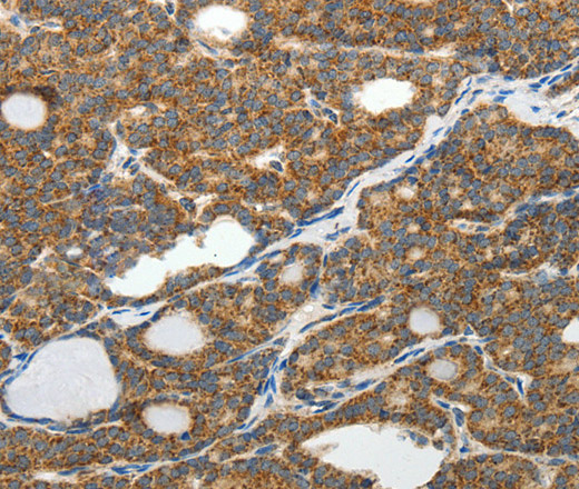 SLC12A4 Polyclonal Antibody (E-AB-14350)