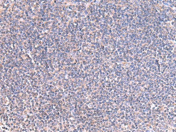 GRIA2 Polyclonal Antibody (E-AB-52034)