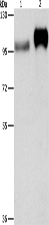 CD61 Polyclonal Antibody (E-AB-14160)