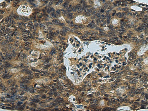 PLTP Polyclonal Antibody (E-AB-52198)