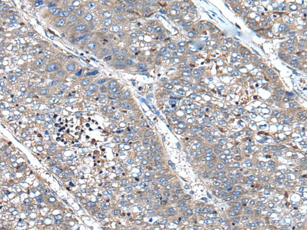 XIRP1 Polyclonal Antibody (E-AB-53552)