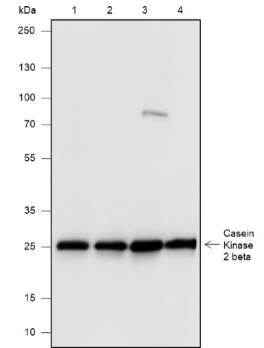 Recombinant Casein Kinase 2 beta Monoclonal Antibody (AN301820L)