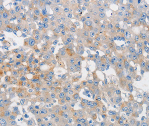 MUC5AC Polyclonal Antibody (E-AB-12578)
