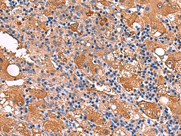 FUCA2 Polyclonal Antibody (E-AB-52968)