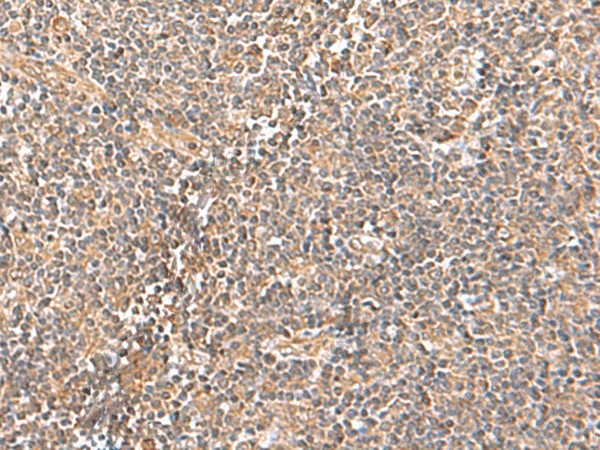 TRUB1 Polyclonal Antibody (E-AB-52904)