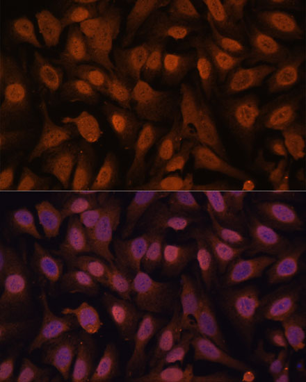 ZNF131 Polyclonal Antibody (E-AB-65269)
