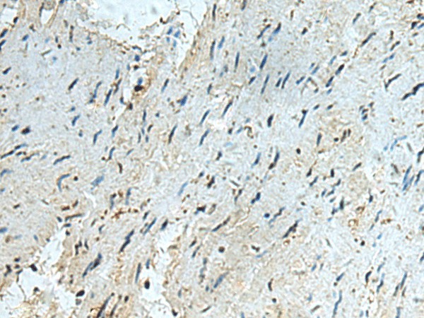 RAPSN Polyclonal Antibody (E-AB-53167)