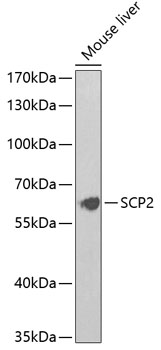 SCP2 Polyclonal Antibody (E-AB-62906)