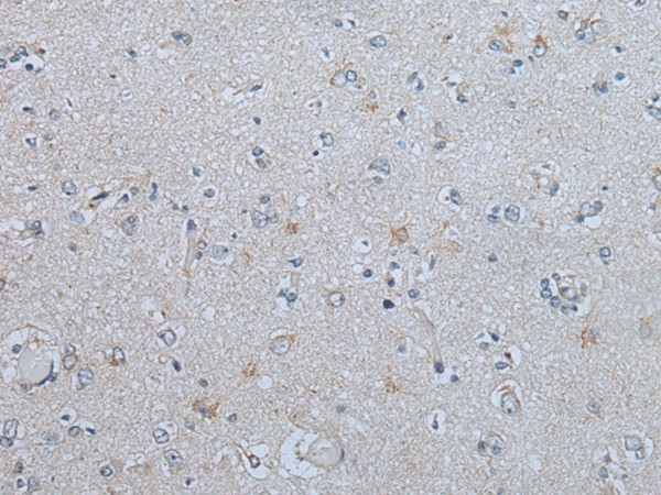 CENPF Polyclonal Antibody (E-AB-53524)