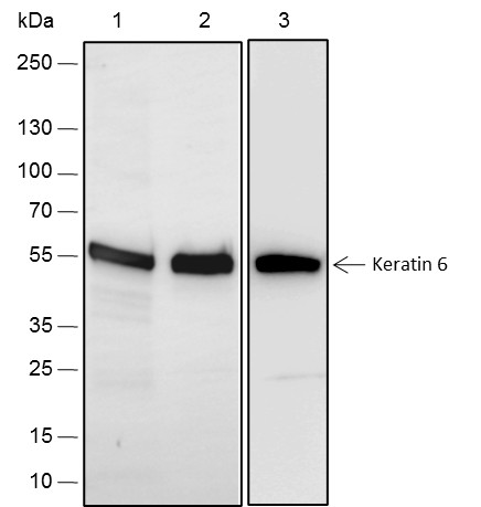 Recombinant Keratin 6 Monoclonal Antibody (AN301582L)