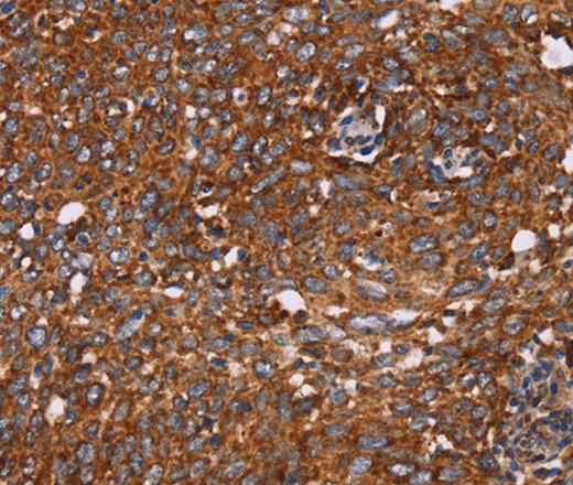 CYP2W1 Polyclonal Antibody (E-AB-11119)