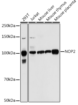 NOP2 Polyclonal Antibody (E-AB-92157)